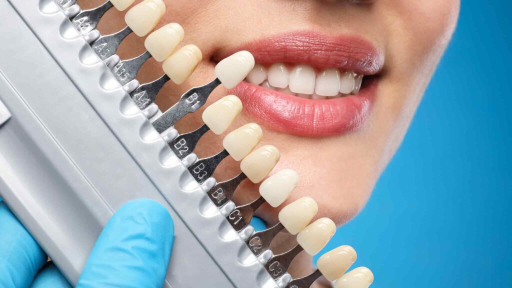 Cosmetic Dentistry Services That Can Transform Your Smile Bright smile after cosmetic dentistry services treatment.
